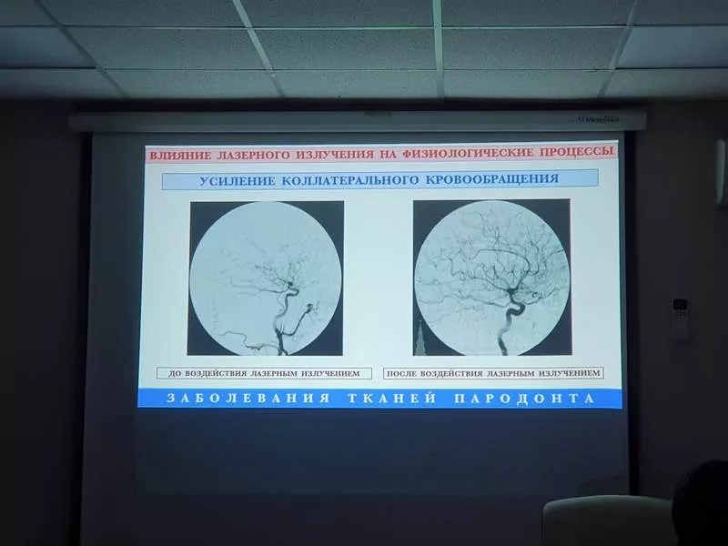 Семинар по пародонтологии 12 февраля г.Москва