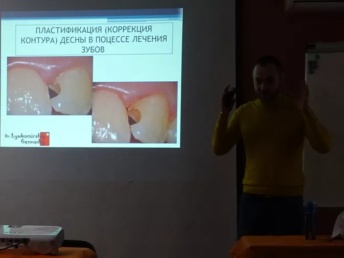 Особенности применения диодного лазерного излучения при реставрации дефектов твердых тканей зубов Особенности применения диодного лазерного излучения при реставрации дефектов твердых тканей зубов