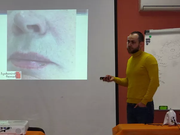 Гемангиома губы Гемангиома губы